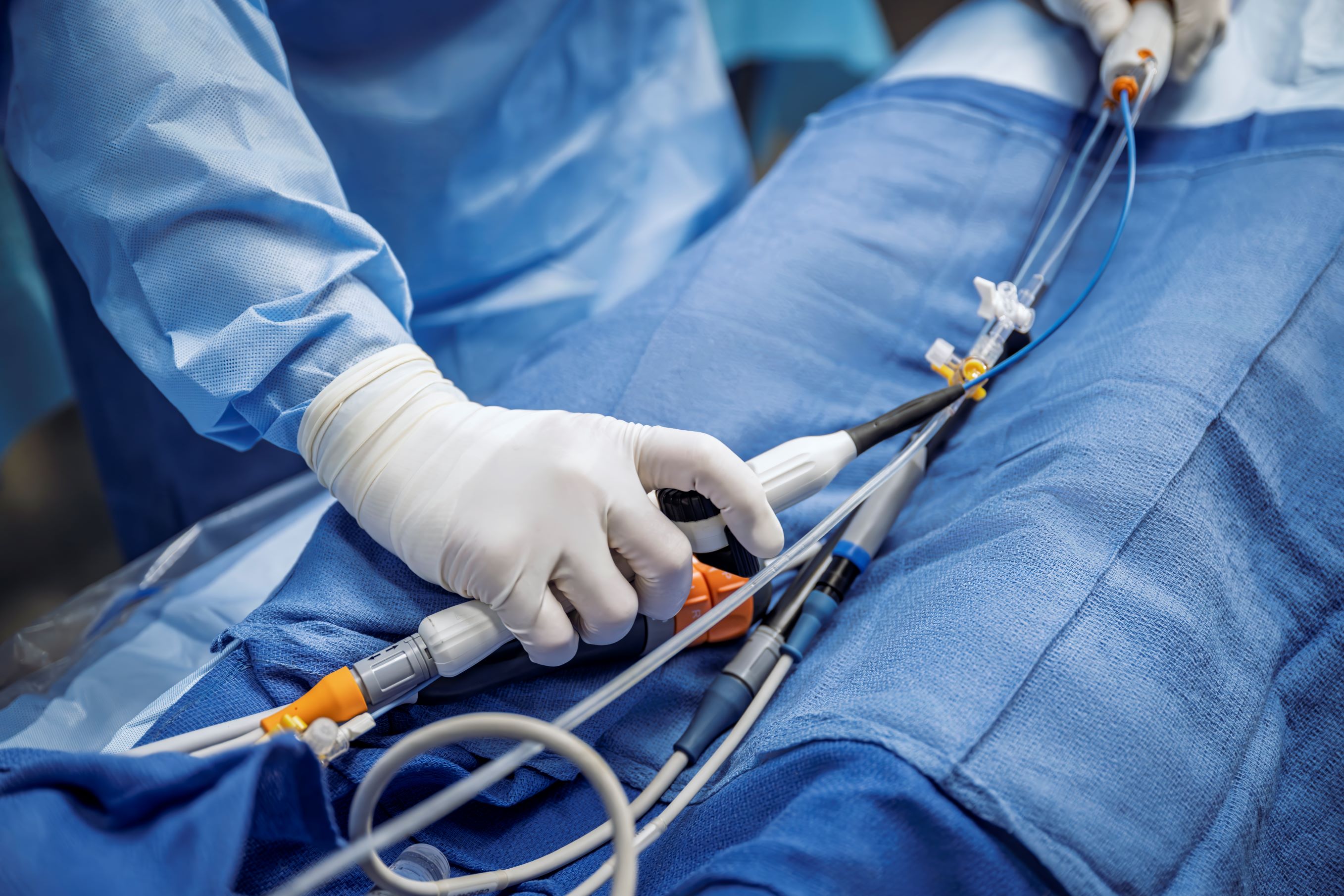 Image of a catheter procedure
